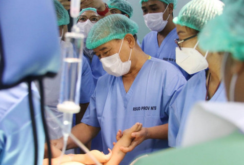 Terobosan Baru: RSUD Provinsi NTB Sukses Lakukan Operasi Bayi Kembar Siam